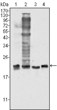 SOD1 Primary Antibody MP20349 [M6F5]