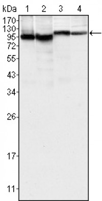 BTK Primary Antibody MP20132 [M7F12H4]