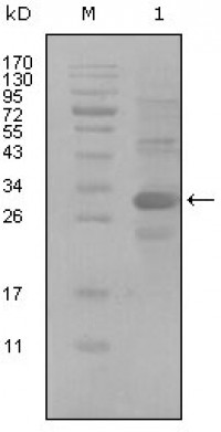 ALCAM Primary Antibody MP20216 [M3F8B12]