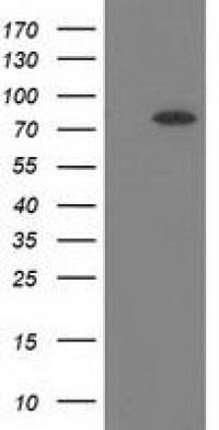 Anti-BCHE / Cholinesterase Antibody (clone 4C12) MX-C172572
