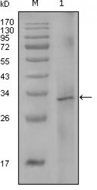 F8 Primary Antibody MP20278 [M5E9B2]