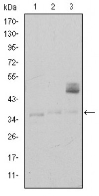 CD1A Primary Antibody MP30187 [M7A7]