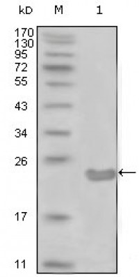 CD10 Primary Antibody MP20257 [M3G9D10]