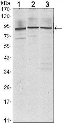 IGF2BP3 Primary Antibody MP30129 [M8F11]