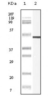 Vimentin Primary Antibody MP20118 [M9E7E7]