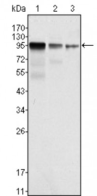 FER Primary Antibody MP20152 [M5D2C4]