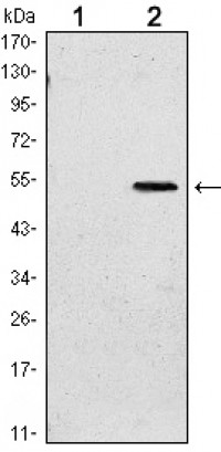SUZ12 Primary Antibody MP30143 [M3D10]