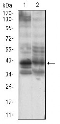 B3GALT4 Primary Antibody MP30642 [M5F12B8]
