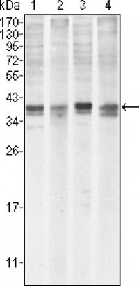 MCL-1 Primary Antibody MP20027 [M8C6D4B1]