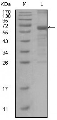MSH6 Primary Antibody MP20192 [M3A10H7]