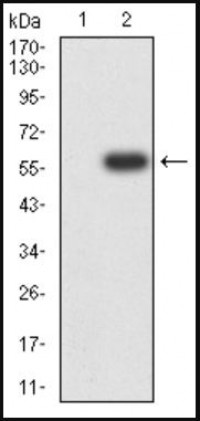 XIAP Primary Antibody MP31695  [M4C12G10]