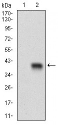 CD93 Primary Antibody MP30570 [M1A10E10]
