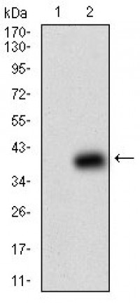 B2M Primary Antibody MP30596 [M3G5H8]