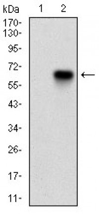 CDKN2A Primary Antibody  MP30616T [M1D7D2A1]