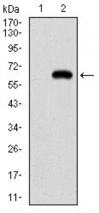 PPARGC1B Primary Antibody MP30665T [M1C1C2]