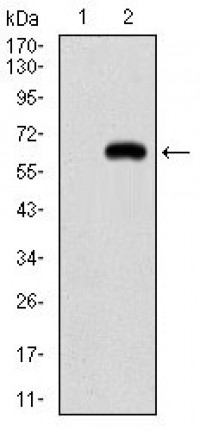 PPARGC1B Primary Antibody MP30665 [M1C1C2]