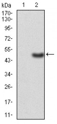ERCC1 Primary Antibody MP30782T [M1E5B3]
