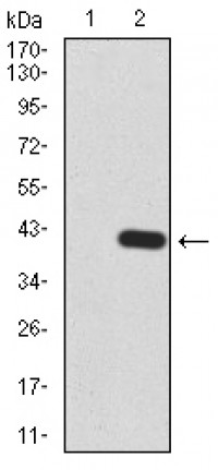 KDM5B Primary Antibody MP30836 [M7H3D7]