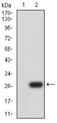 UCP3 Primary Antibody MP31002 [M6B8C6]