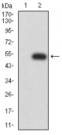 MET Primary Antibody MP31098 [M5E9C4]