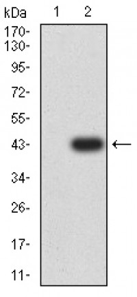 SATB2 Primary Antibody  MP31652  [M7B2C4]