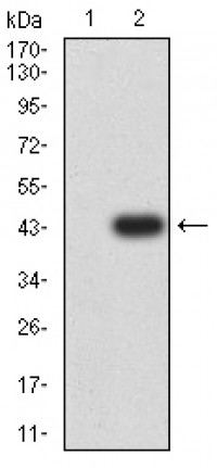KDR Primary Antibody  MP31661 [M1A9A3]