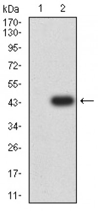 CD306 Primary Antibody  MP31668 [M8C12B6]