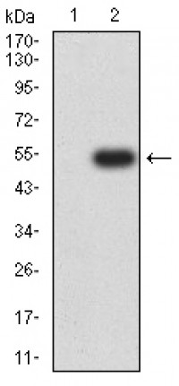 KAT7 Primary Antibody MP31672  [M1D9H9]