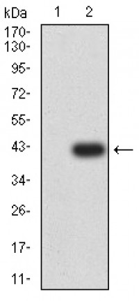 SIRT2 Primary Antibody MP31704 [M5H11H9]