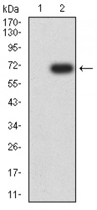 CD5 Primary Antibody MP31706  [M3D3G6]