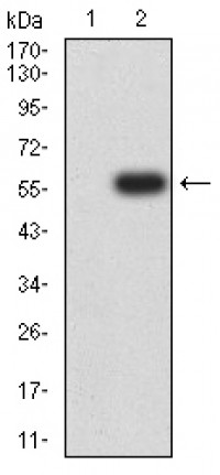 MSLN Primary Antibody  MP31741 [M4H12F8]