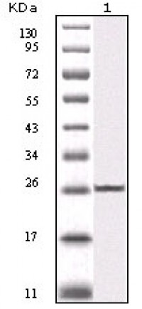 IKBKB Primary Antibody MP20114 [M10A2C5B3]