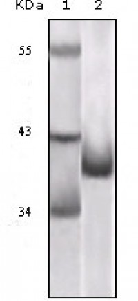 P16 (Mouse and Human) Primary Antibody MP20130 [M1E12E10]