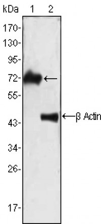 ZAP70 Primary Antibody MP20064 [M3D2A4]