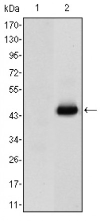 CEA Primary Antibody MP30156 [M3G12]