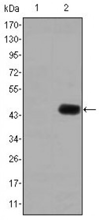CEA Primary Antibody MP30157 [M1C7]