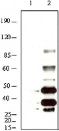 KSHV K8a Primary Antibody MP20015 [M8C12G10G1]