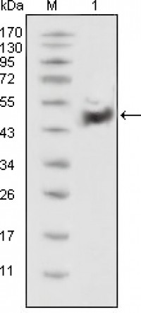 p53 Primary Antibody MP20338 [M4A8]