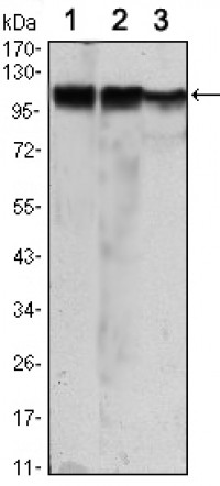 HK2 Primary Antibody MP30088 [M3D3]