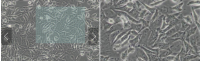 MCF0072  人肝癌细胞；SK-HEP-1