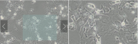 MCF0077  人肝癌细胞；Hep3B2.1-7