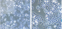MCF0079  人肝癌细胞；BEL-7402