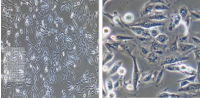 MCF0086  人肺腺癌细胞；NCI-H1975