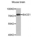 anti-HYAL1 antibody (Hyaluronidase-1) (N-Term)