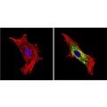 anti-HYAL1 antibody (Hyaluronidase-1) (N-Term)