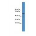 anti-HYAL1 antibody (Hyaluronidase-1) (N-Term)