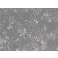 anti-HYAL1 antibody (Hyaluronidase-1) (N-Term)