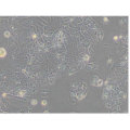 anti-HYAL1 antibody (Hyaluronidase-1) (N-Term)