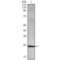 anti-HYAL1 antibody (Hyaluronidase-1) (N-Term)