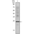 anti-HYAL1 antibody (Hyaluronidase-1) (N-Term)